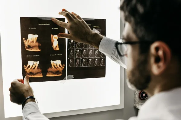 Cada cuánto ir al dentista