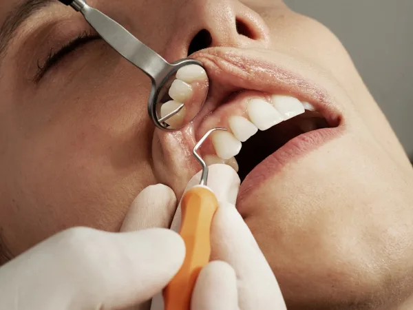 Urgencia dental en Providencia
