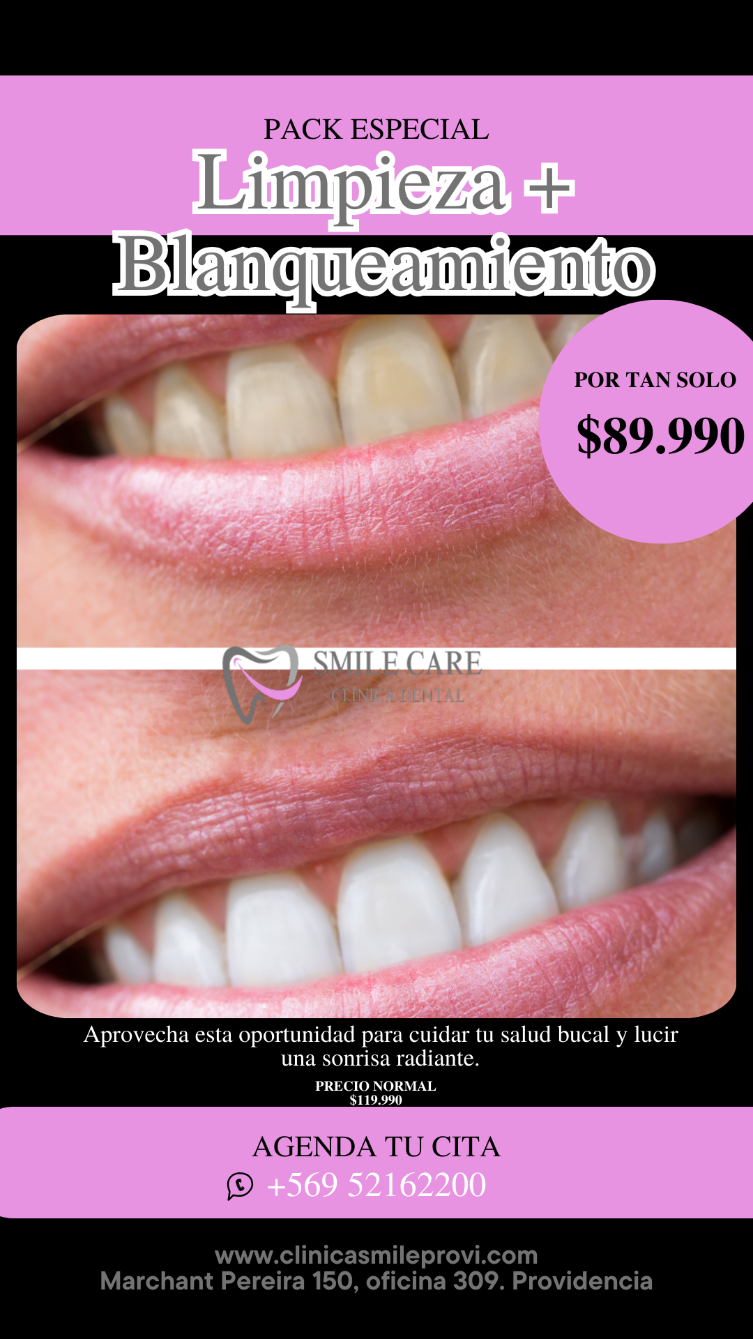 Pack Limpieza + Blanqueamiento — $89.990